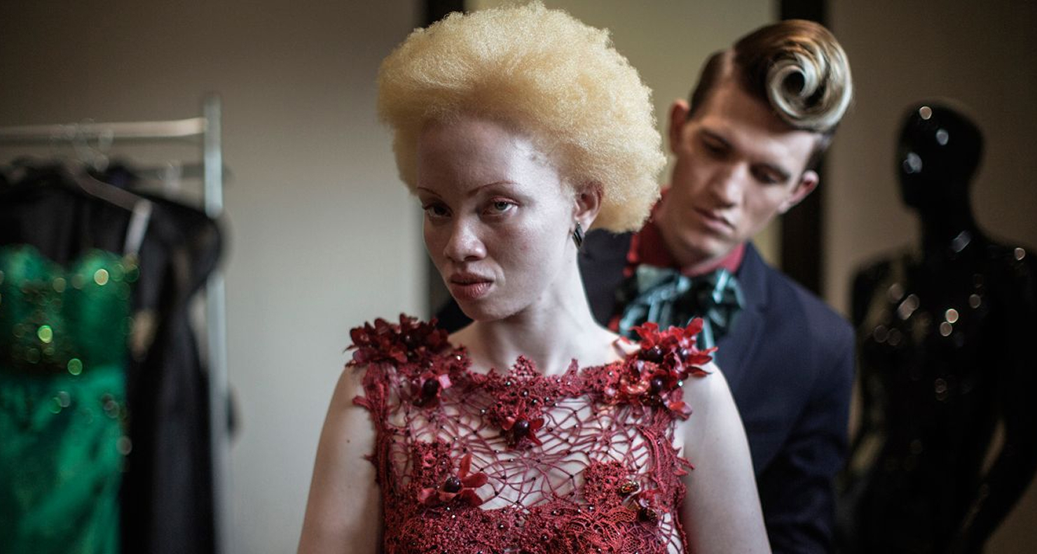 Concours de beauté pour personnes albinos : l’Afrique célèbre la diversité et déconstruit les préjugés