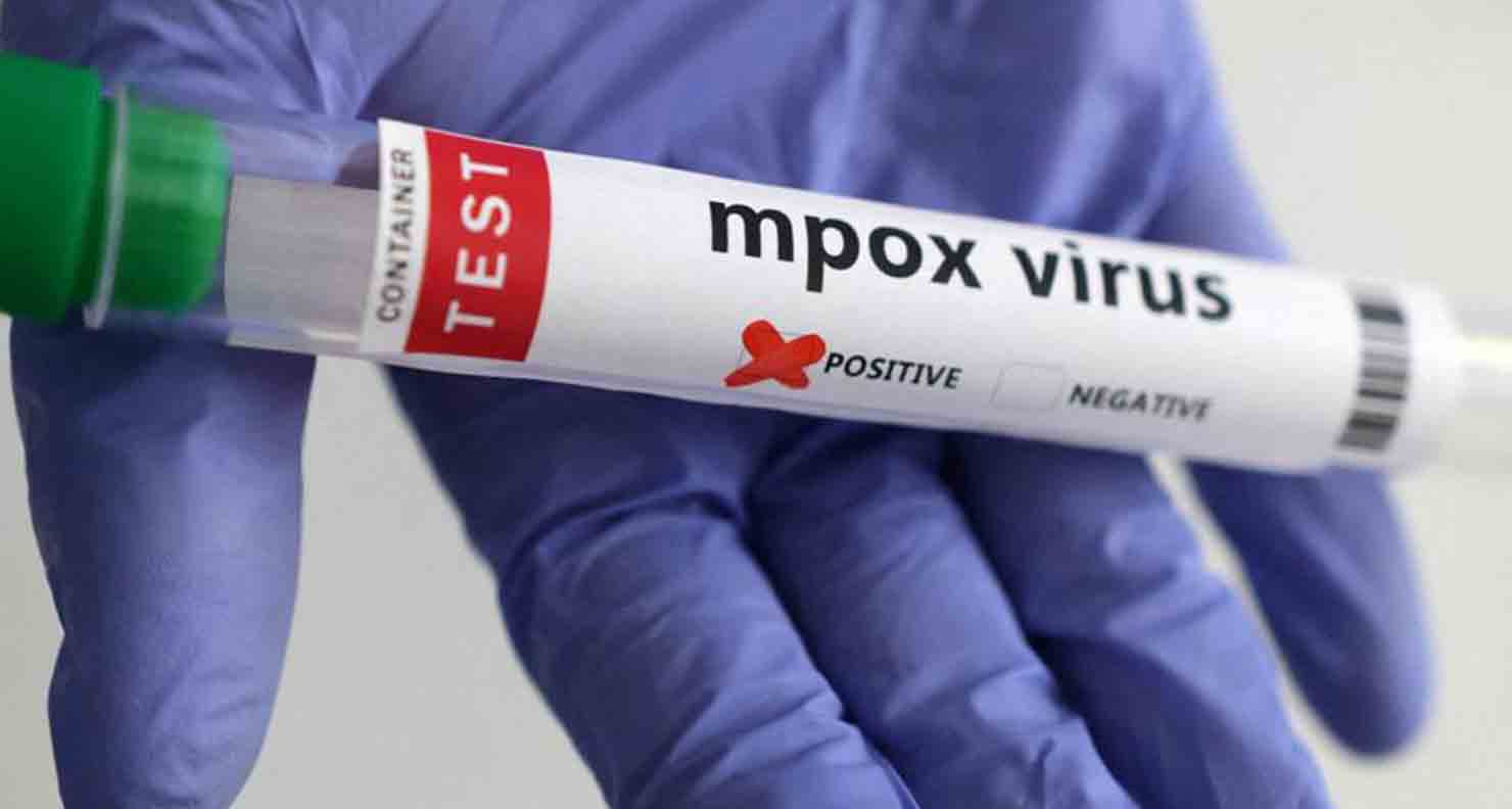 Le Sénégal annonce la guérison totale du mpox et appelle à la vigilance collective